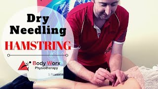 Dry Needling Hamstring  Jason Bradley BodyWorx Physio [upl. by Curtice]