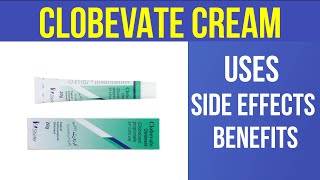 CLOBEVATE CREAM Uses Side Effect amp Benefits Urdu  Dr Review [upl. by Edualcnaej]