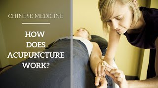 Chinese Medicine Basics  How does Acupuncture work [upl. by Estella]