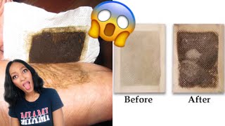 I TESTED DETOX FOOT PADS FOR 5 DAYS DO THEY WORK [upl. by Noffihc]