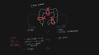 Know your caecal volvulus from sigmoid volvulus [upl. by Anyale]