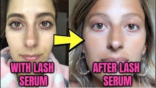 WHAT HAPPENS AFTER LASH SERUM IM HERE TO TELL YOU Before amp After Results [upl. by Bullis]