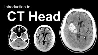 Introduction to CT Head Approach and Principles [upl. by Sampson143]