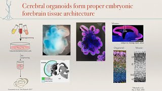 Modeling Human Brain Structure and Function Using Cerebral Organoids with Madeline Lancaster [upl. by Patnode213]