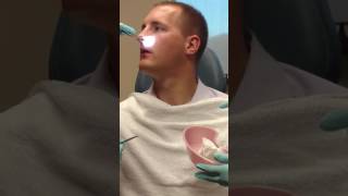 Septoplasty Turbinate reduction splint removal [upl. by Wandie]