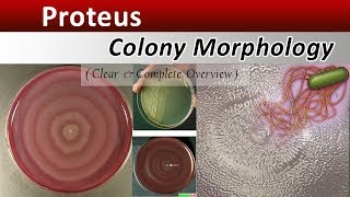 Proteus Colony Morphology  Clear Explain [upl. by Hayouqes715]