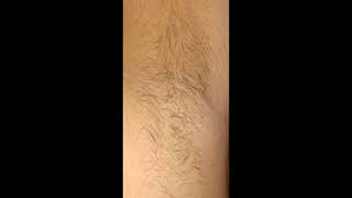 Armpit hair growth in 30 days timelapse [upl. by Suilenrac313]