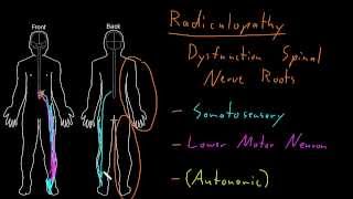 Syndrome Radiculopathy [upl. by Nerval104]