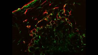 Inside a Vascular Organoid [upl. by Hterag]