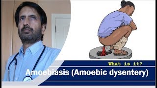 Amoebiasis Amoebic dysentery  Symptoms of dysentery [upl. by Ennahgem834]