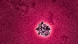 Lactobacillus  Time Lapse Photography [upl. by Drawde68]