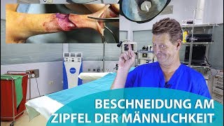 Beschneidung am Zipfel der Männlichkeit [upl. by Farver]