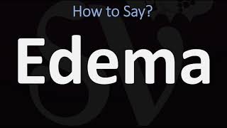 How to Pronounce Edema CORRECTLY [upl. by Edlun]