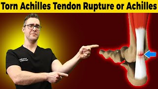 Torn Achilles Tendon Rupture or Achilles Tendonitis HOW TO TELL [upl. by Anbul198]