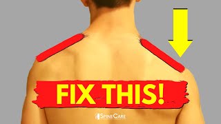 Understanding Shoulder Pain and How To Fix It [upl. by Anisor]