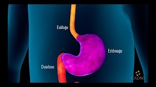 Endoscopia Digestiva Alta [upl. by Ivan181]