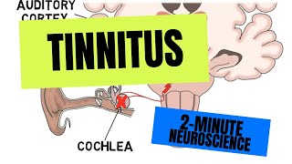 2Minute Neuroscience Tinnitus [upl. by Joann81]