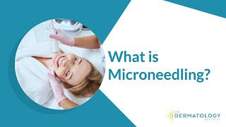 What is Microneedling  Microneedling Treatment [upl. by Warfeld117]