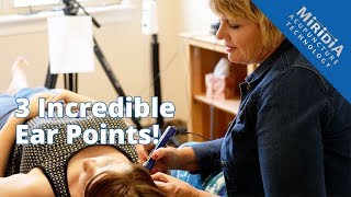 3 Powerful Ear Acupuncture Points that Enhance any Treatment [upl. by Meekar]