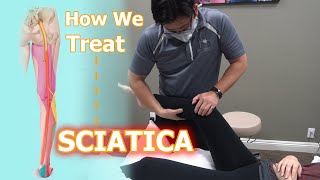 How We Treat Sciatica  Physical Therapy [upl. by Jacquelin]