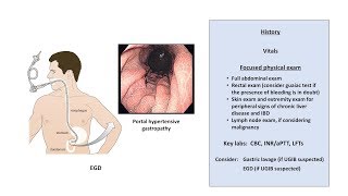 An Approach to GI Bleeding Melena Hematemesis Hematochezia [upl. by Redna]