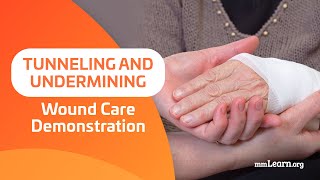 Tunneling and Undermining  Wound Care Demonstration [upl. by Ynaffital564]