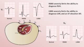 flexor carpi radialis and ulnaris MMT [upl. by Loella]