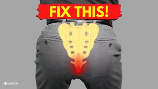 How to Fix Tailbone Pain for Good [upl. by Ataliah]