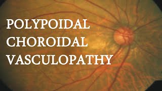 OCT in PACHYCHOROIDAL VASCULOPATHY [upl. by Alderman620]