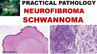 Introduction to Brain Surface Anatomy [upl. by Kelton]