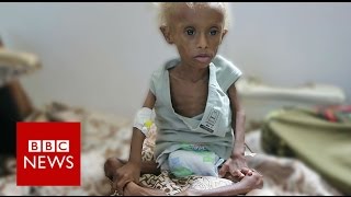 Yemen On the brink of starvation  BBC News [upl. by Janette]