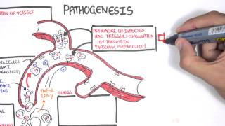 Malaria Pathophysiology [upl. by Herbie]