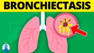 Bronchiectasis Medical Definition  Quick Explainer Video [upl. by Ainocal]