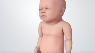 Infant Distress Warning Signs Grunting Baby Sound [upl. by Snowman]