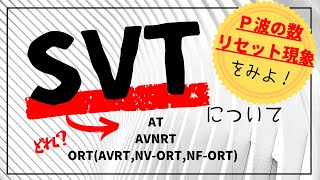 Atrioventricular reentrant tachycardia AVRT amp nodal reentrant tachycardia AVNRT [upl. by Eihtak]