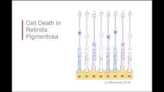 Retinitis Pigmentosa 2 Biology [upl. by Liahkim]