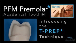 PFM Premolar Using TPREP Technique  Acadental Tooth 4 [upl. by Cobbie]