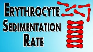 Erythrocyte Sedimentation Rate [upl. by Neetsuj]