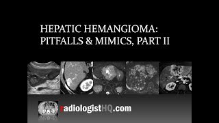 Hepatic Hemangioma Pitfalls amp Mimics Part II [upl. by Aneema]