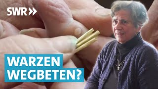 Warzen entfernen – Was hilft wirklich [upl. by Kaplan]