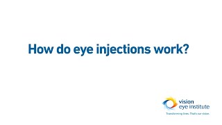 New Research on Heart Attack and Stroke Risk Tied to Common Eye injection Treatment for AMD [upl. by Owain]