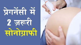 Boy or Girl लड़का या लड़की kaise pata kare Gender myth Dr Shikha Agarwal [upl. by Tnattirb]