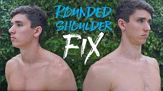 Fixing Rounded Shoulders and Nerd Neck FULL ROUTINE [upl. by Mab]