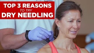 Top 3 Reasons to Try Dry Needling [upl. by Aikenahs793]