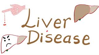 Liver Disease and Hemostasis Disorders [upl. by Nalepka610]