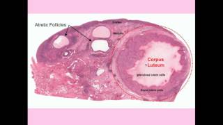 Ovarian Cysts  CRASH Medical Review Series [upl. by Anikal]