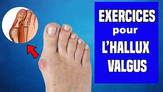 HALLUX VALGUS  TRAITEMENT ET EXERCICES KINÉ [upl. by Novaj]