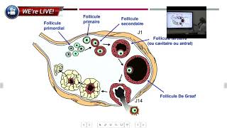 KYSTES OVARIENS Causes Symptômes Diagnostic Complications Traitements Prévention Dr Eyetemou [upl. by Brill]