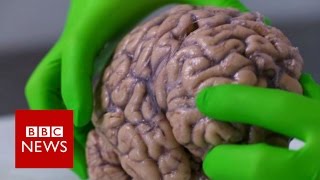 Up close with a human brain  BBC News [upl. by Karmen]