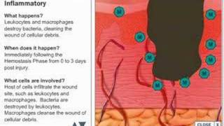 Wound Healing Process [upl. by Iruy]